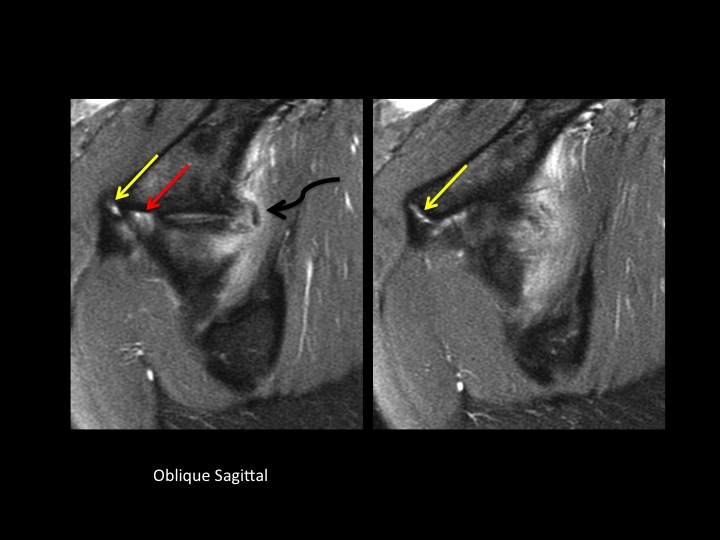 Figure 2 for case rectus femoris muscle ( RID2698 )
